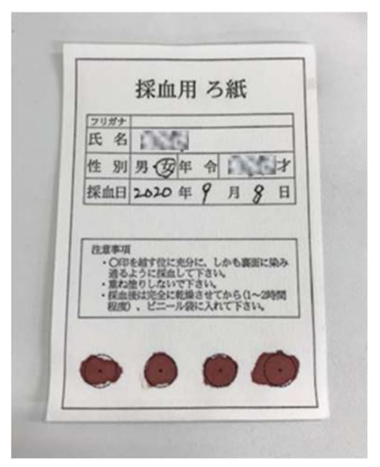 医療施設に行かずに、抗体検査可能